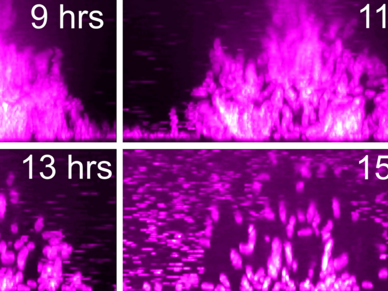Series of microscopic images shows dispersion of vibrio cholerae bacteria over time.