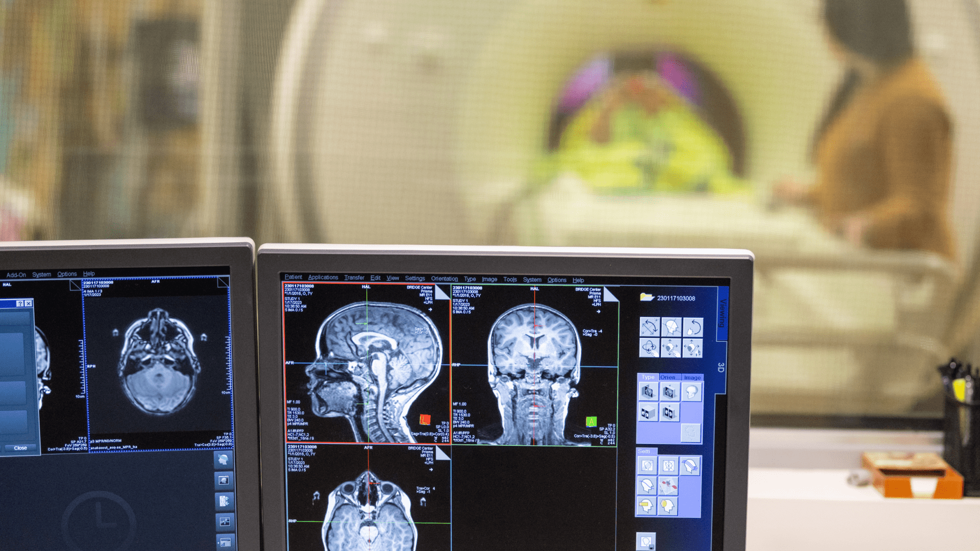 MRI machine in background with computer showing brain scan imaging in front